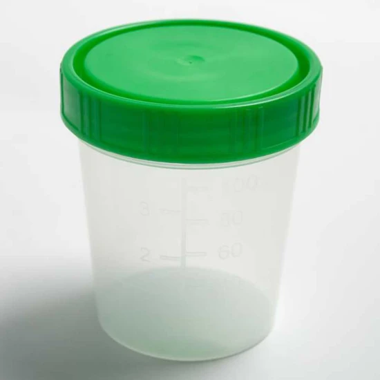 Csavaros fedél 100ml vizeletpohárhoz