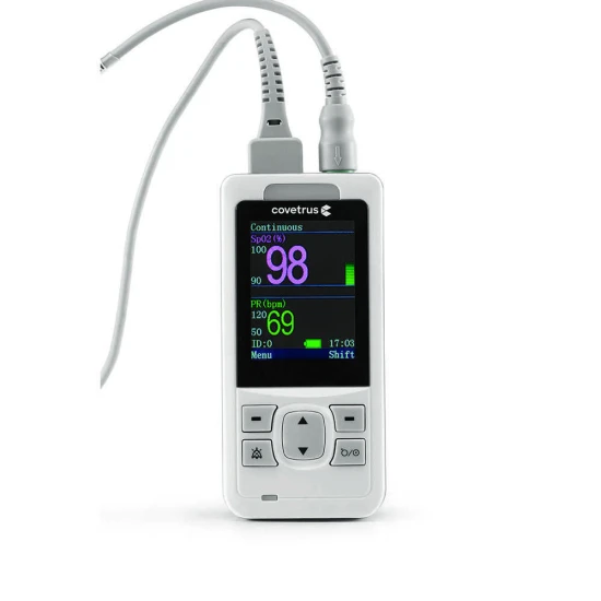 Állatorvosi monitor EKG funkcióval